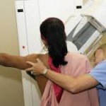Mammogram being done on a lady