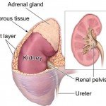 Kidney Cancer – Risk Factors and Causes